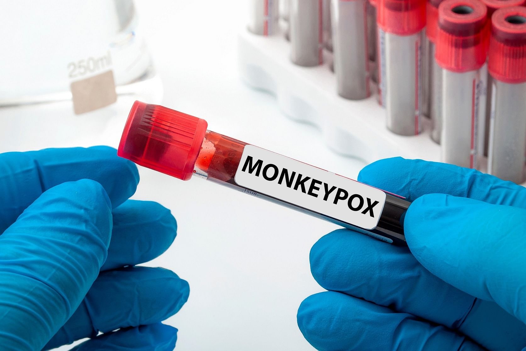 The WHO had on Saturday declared monkeypox as a global public health emergency of international concern. Credit: IANS Photo