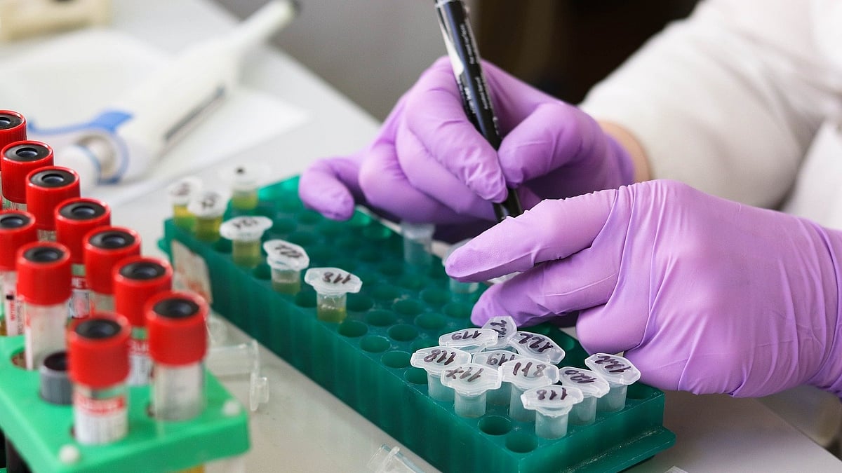 Dope Testing Explained | What is a dope test?