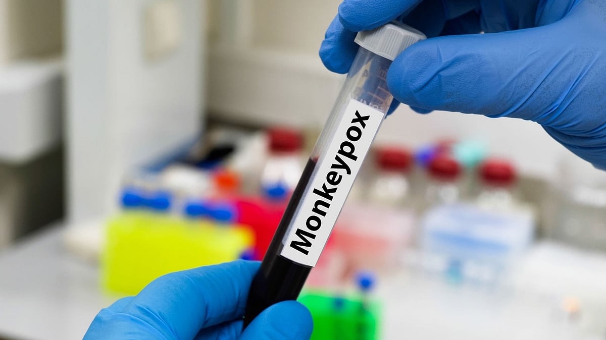 First case of monkeypox in Japan detected in Tokyo