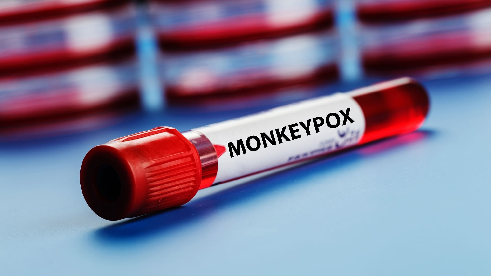In Europe, in recent weeks there has been a slowing in the rate of increase in new monkeypox cases each week. Credit: IANS photo