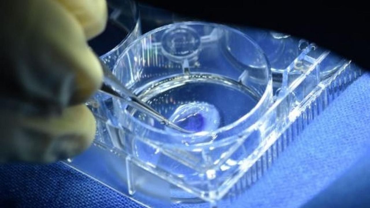 A 3-D printed human cornea developed in Hyderabad. Credit: IANS Photo