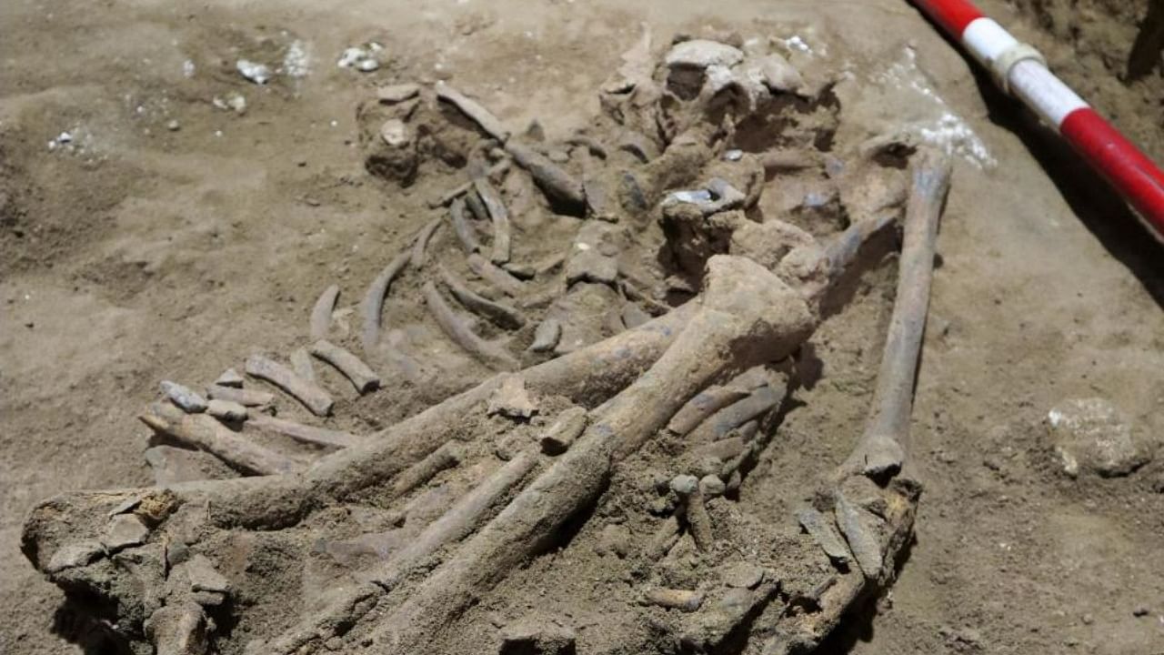 The human skeleton found in Borneo marks the oldest evidence for amputation yet discovered. Credit: AP/PTI Photo