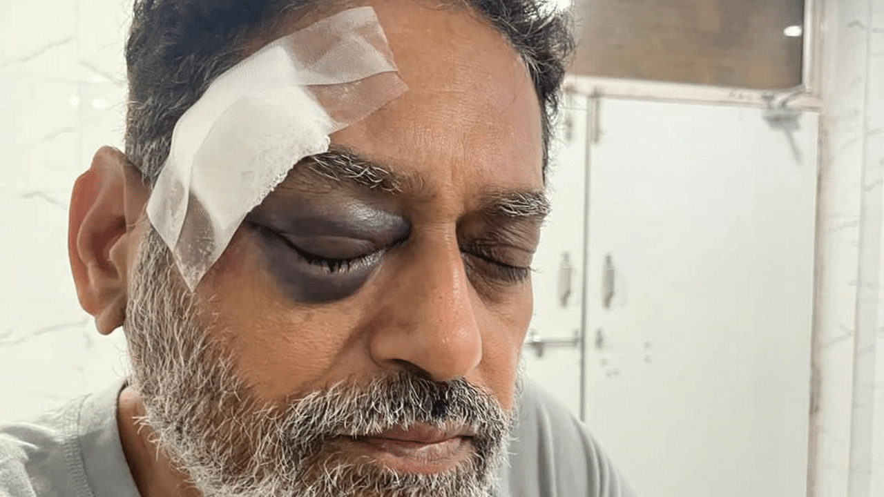 Dr Nitin Raut hurt in the right eyebrow. Credit: Special arrangement