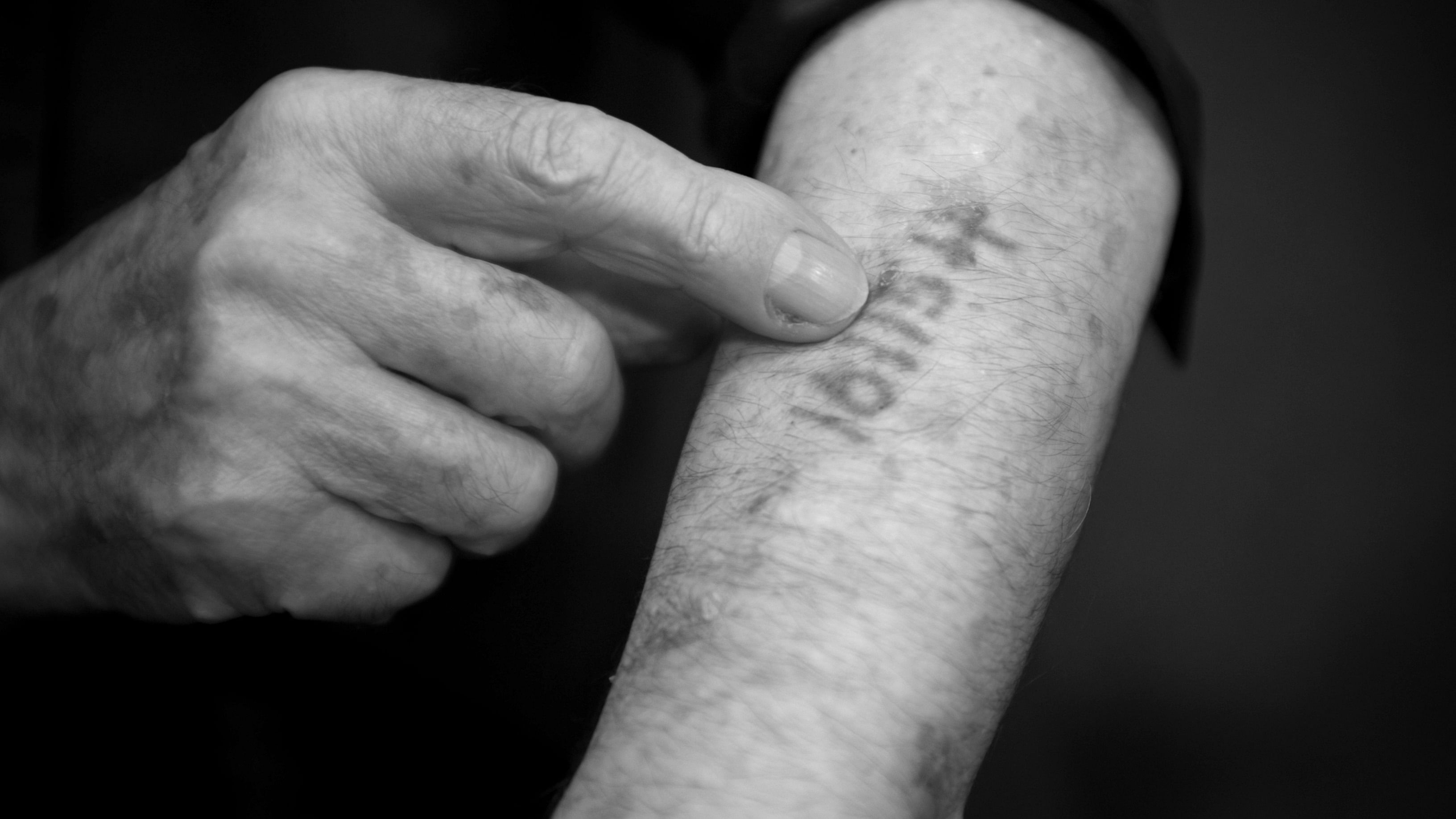 In the Holocaust, the Nazis would tattoo numbers on Jewish prisoners for identification. Credit: iStock Photo