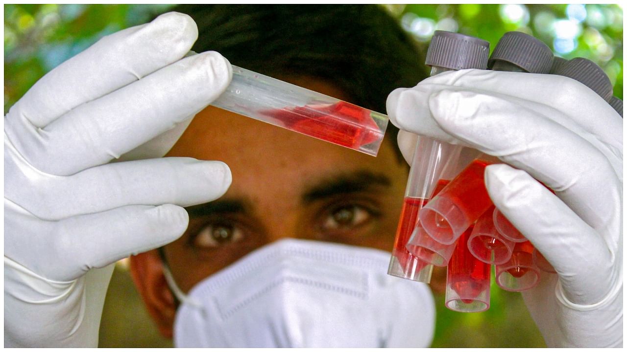 A healthcare worker shows the collected swab samples for Covid-19 test. Credit: PTI Photo